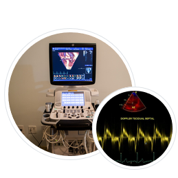 Exames Cardiovasculares